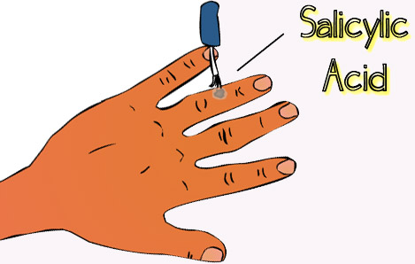 salicylic acid
