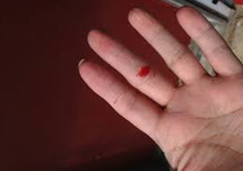 Hình đứt tay troll ngón tay bị cắt chảy máu